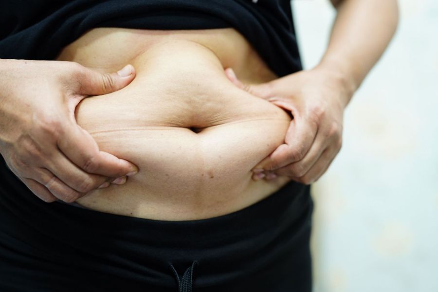 Blog What Comes with Extra Weight or Fat?