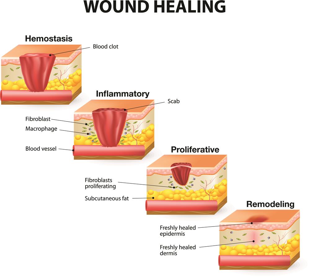 The Role of Vitamin C in Wound Healing image 1